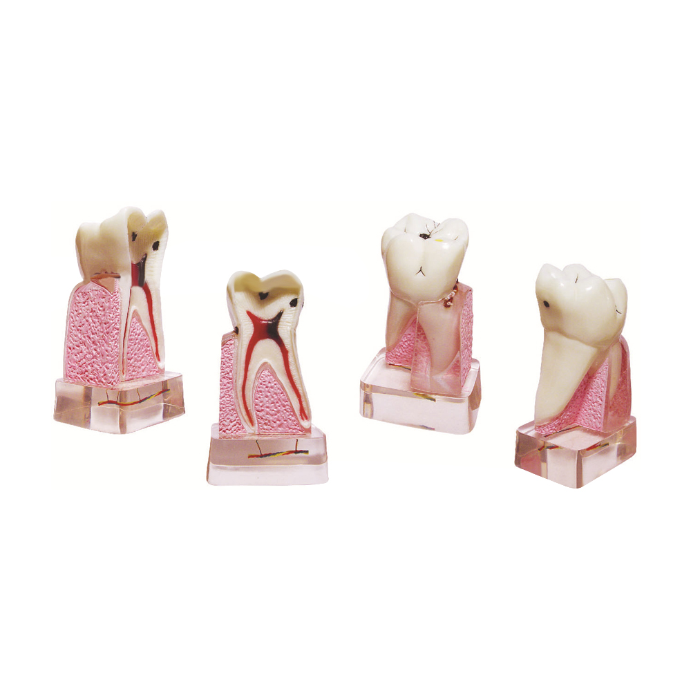Dental Pathological Model, 4x  - огляд і ціна Medical Lab Supplies